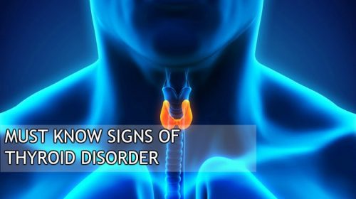 Signs of Thyroid disorder