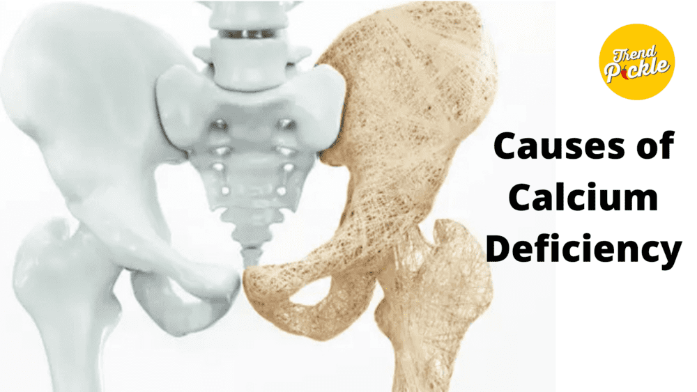 Top 20 Signs That You Might Be Calcium Deficient Trendpickle