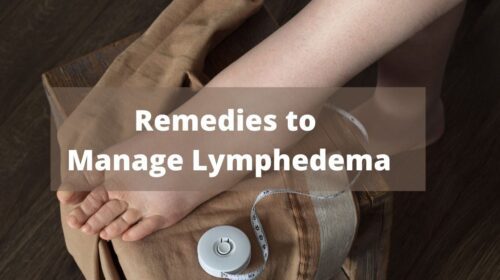 5 Remedies to Manage Lymphedema