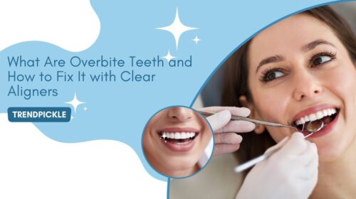 What Are Overbite Teeth and How to Fix It with Clear Aligners